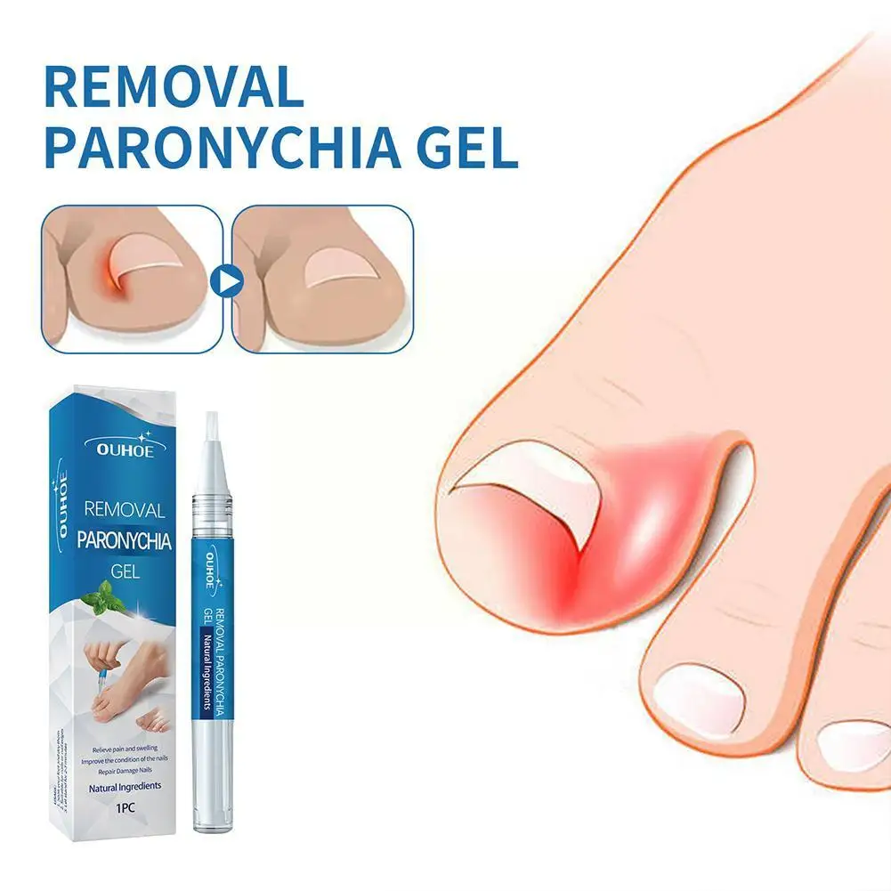 

3ml Nail Fungal Treatment Essence Nail Foot Toe Nail Gel Onychomycosis Anti Infection Shipping Removal Fungus Free Paronych M0W4