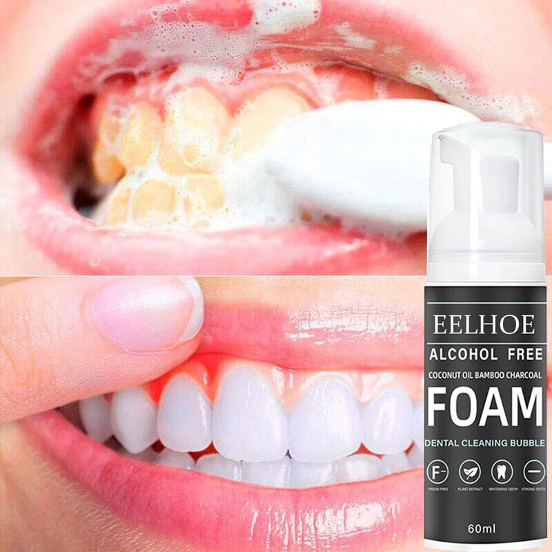 Teeth Whitening Mousse Toothpaste Remove Yellow Teeth Coffee Stains Bleach Teeth Clean Fresh Breath Oral Hygiene Dental Tools