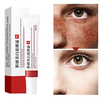 5pcs effective freckle cream face whitening remove melasma acne spot pigment melanin dark spots pigmentation cream skin care