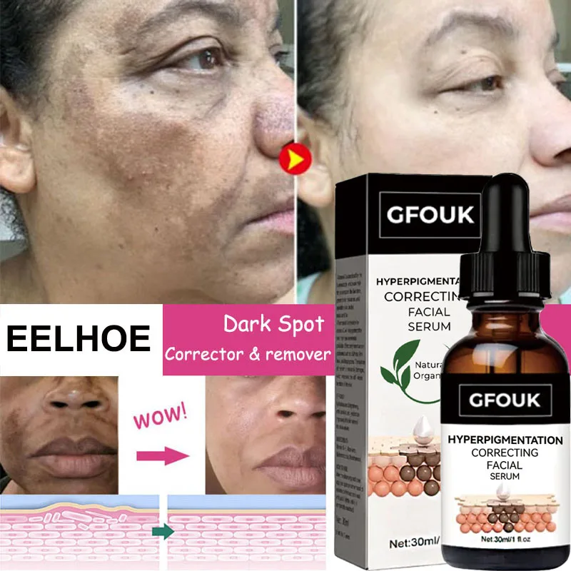 

Whitening Face Serum Remove Dark Spots Freckle Fade Melanin Essence Improve Facial Dull Brighten Moisture Skin Care Product