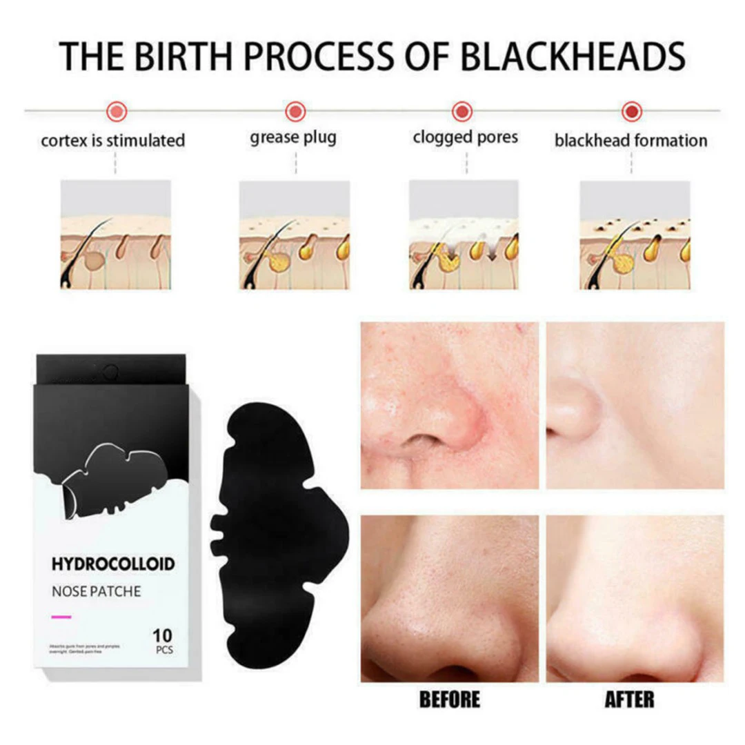 

10 шт., Гидроколлоидные Пластыри для удаления черных точек на носу