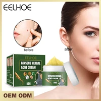 eelhoe ginseng herbal acne cream for face cleans and brightens lightens repairs acne pits scars and gently improves acne skin