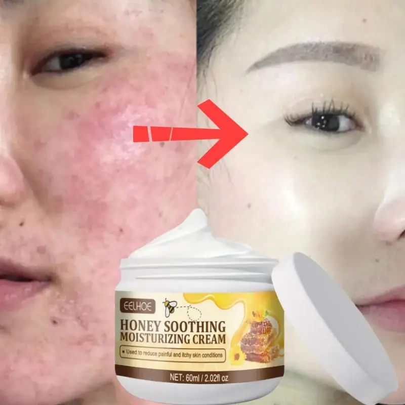 

Высококачественный восстанавливающий крем для лица против красных точек, прыщей и акне