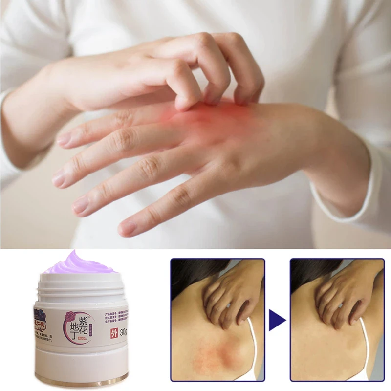 

Антибактериальный крем при псориазе, 30 г