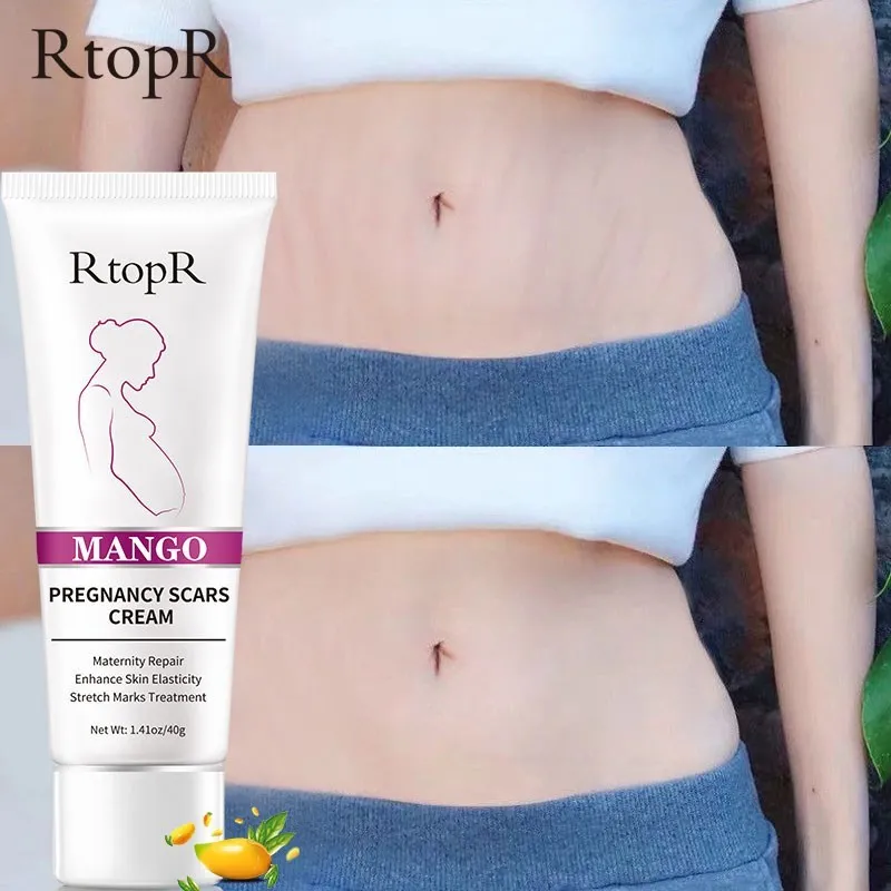 

RtopR Pregnancy Scar Removal Cream Pregnant Women Pigment Correction Repair Body Gel Firming and Brightening Smoothing Skin
