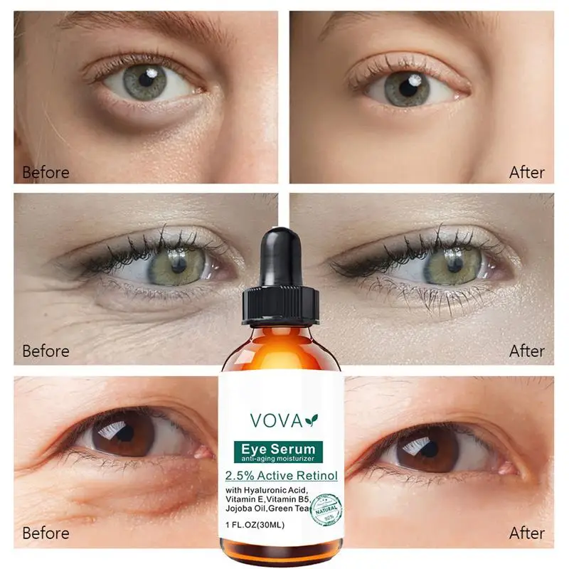 Сыворотка для области вокруг глаз от тёмных кругов и мешков под глазами 30 мл |