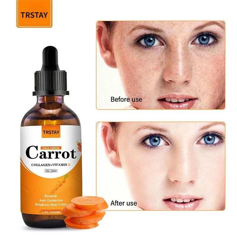 

New Carrot Essence Essential oils Dark Spot Corrector Face Whitening Serum Brighten Blemish Freckle Remover 100% Natural