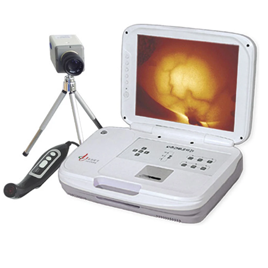 

MCS-LEO-1201 Infrared Mammary Gland Diagnostic Instrument