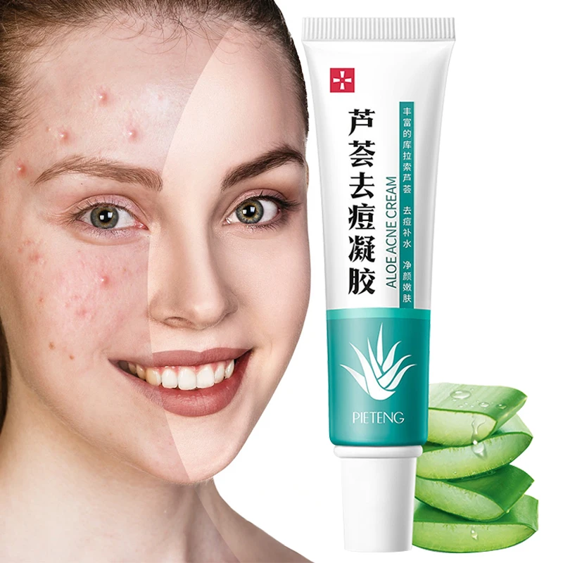 

Aloe Vera Acne Gel Oil Control Nourishing Shrink Pores Repair Rough Anti-Inflammatory Anti-Aging Smooth Tender Skin Care 30g