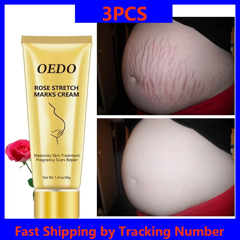 

3PCS Rose Removes Stretch Mark Cream To Remove Postpartum Obesity Pregnant Women Repair Anti-Aging Anti-Winkles Firming Cream