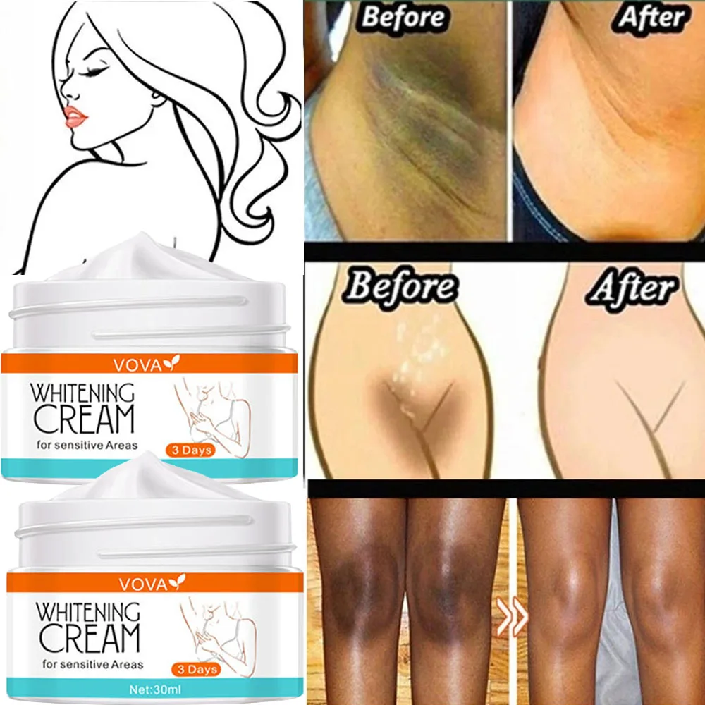

Effective Body Whitening Cream Underarm Armpit Ankles Elbow Private Parts Bleach Moisturizing Brighten Skin Care Beauty Cosmetic