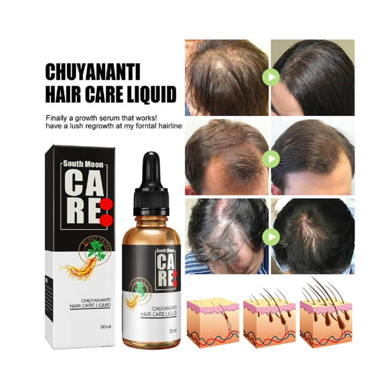 

Anti-Hair Loss Essence Set Nourishing Scalp Strong Hair Root Pure Natural Herbal Plant Essence Korean Beauty Health