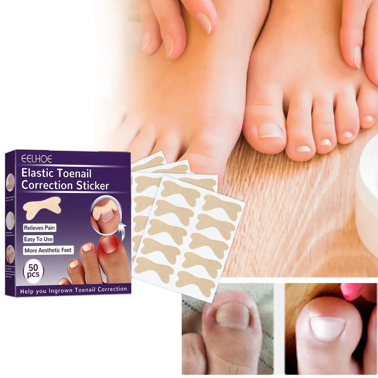 

50/100pcs Nail Art Ingrown Correction Sticker Foot Fixer Care Paronychia Pedicure Waterprof Patch Corrector Recover Tool To Q2D8