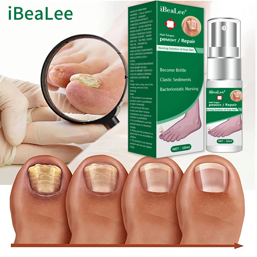 

Эссенция для лечения грибка ногтей iBeaLee, восстанавливающий гель для удаления грибков ногтей, уход за ногами, сыворотка против инфекции, паронихия и онихомикоз