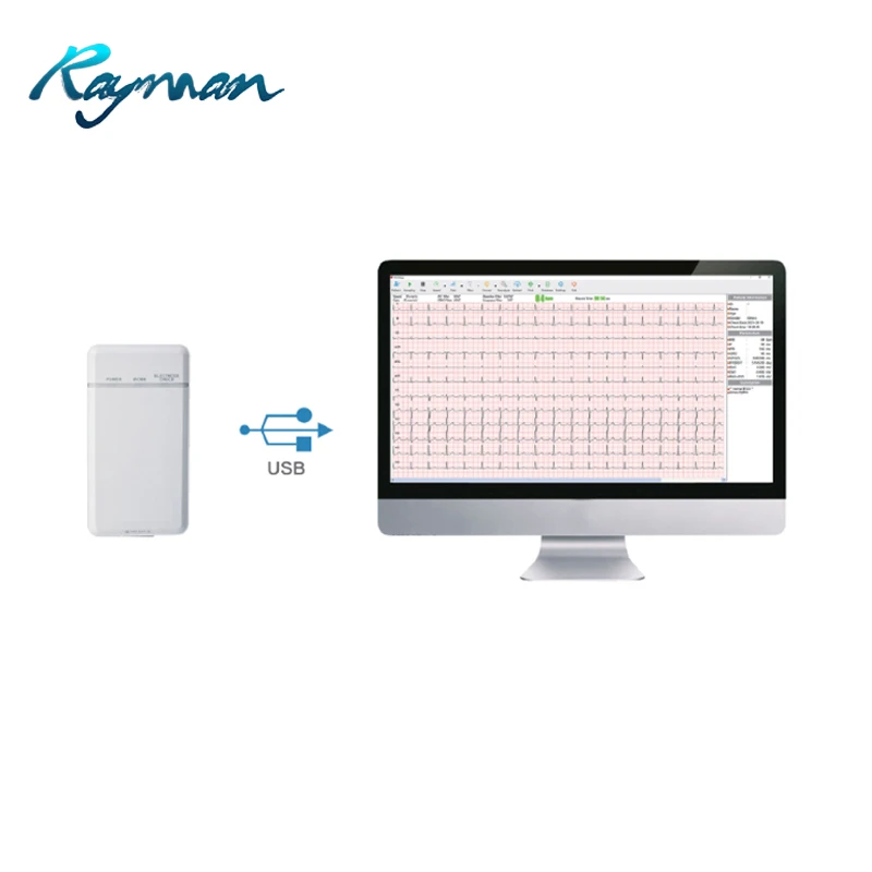 Портативная беспроводная беговая дорожка и Эргометр для ЭКГ-терапии