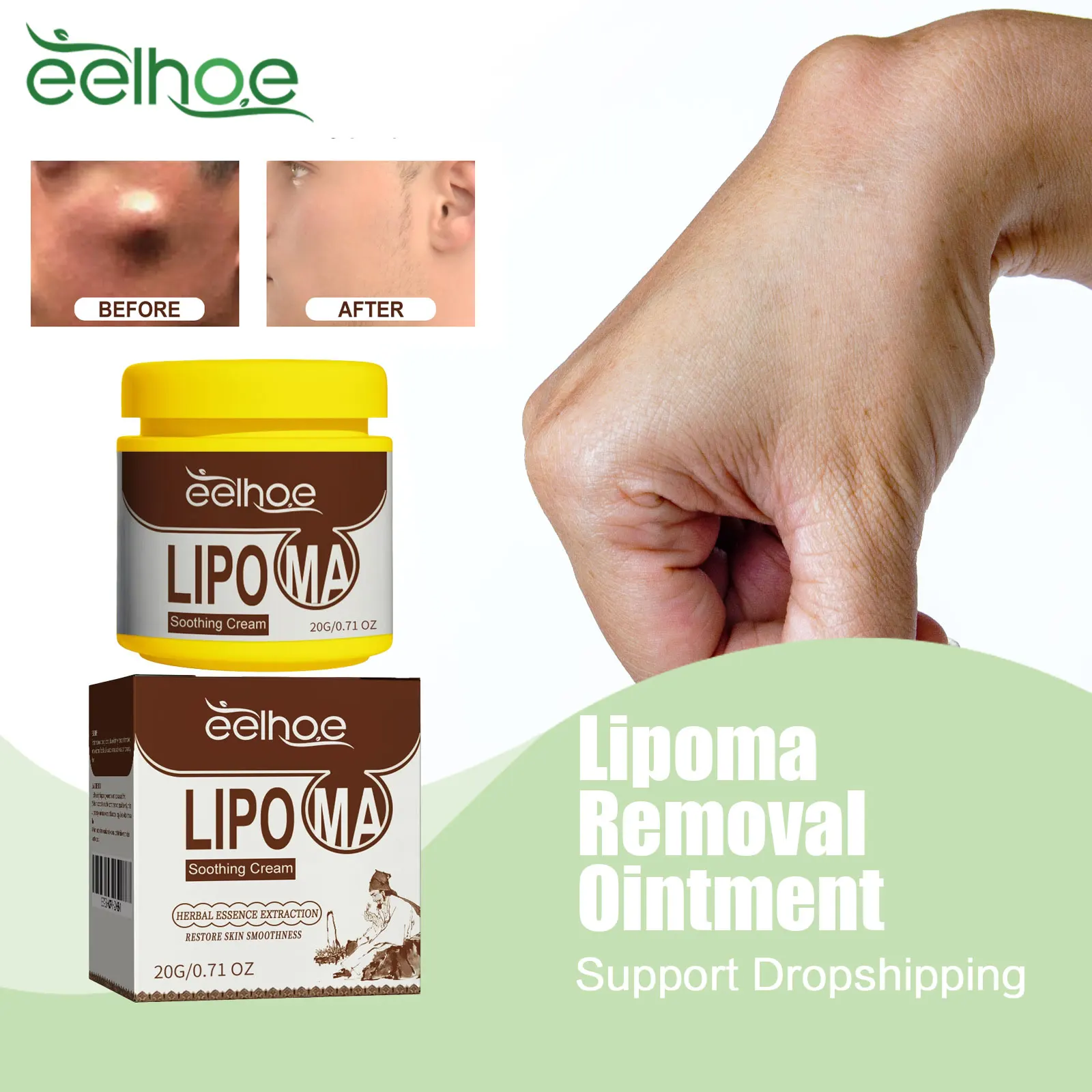 Мазь Lipoma для удаления опухолей, лечения опухолей, обезболивания ...