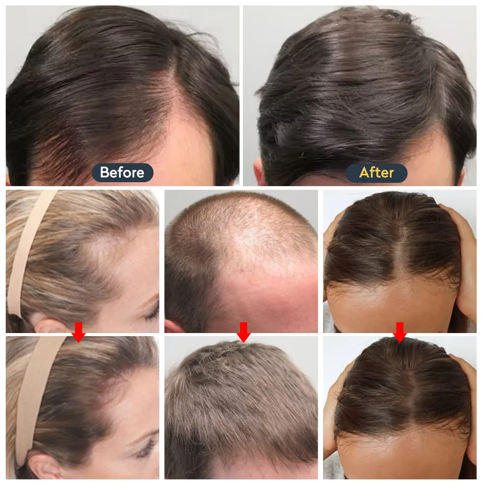 

Hair Growth Oil Fast Hair Growth Effective Treatment for Baldness Hereditary Hair Loss Postpartum Hair Loss Seborrheic Hair Loss