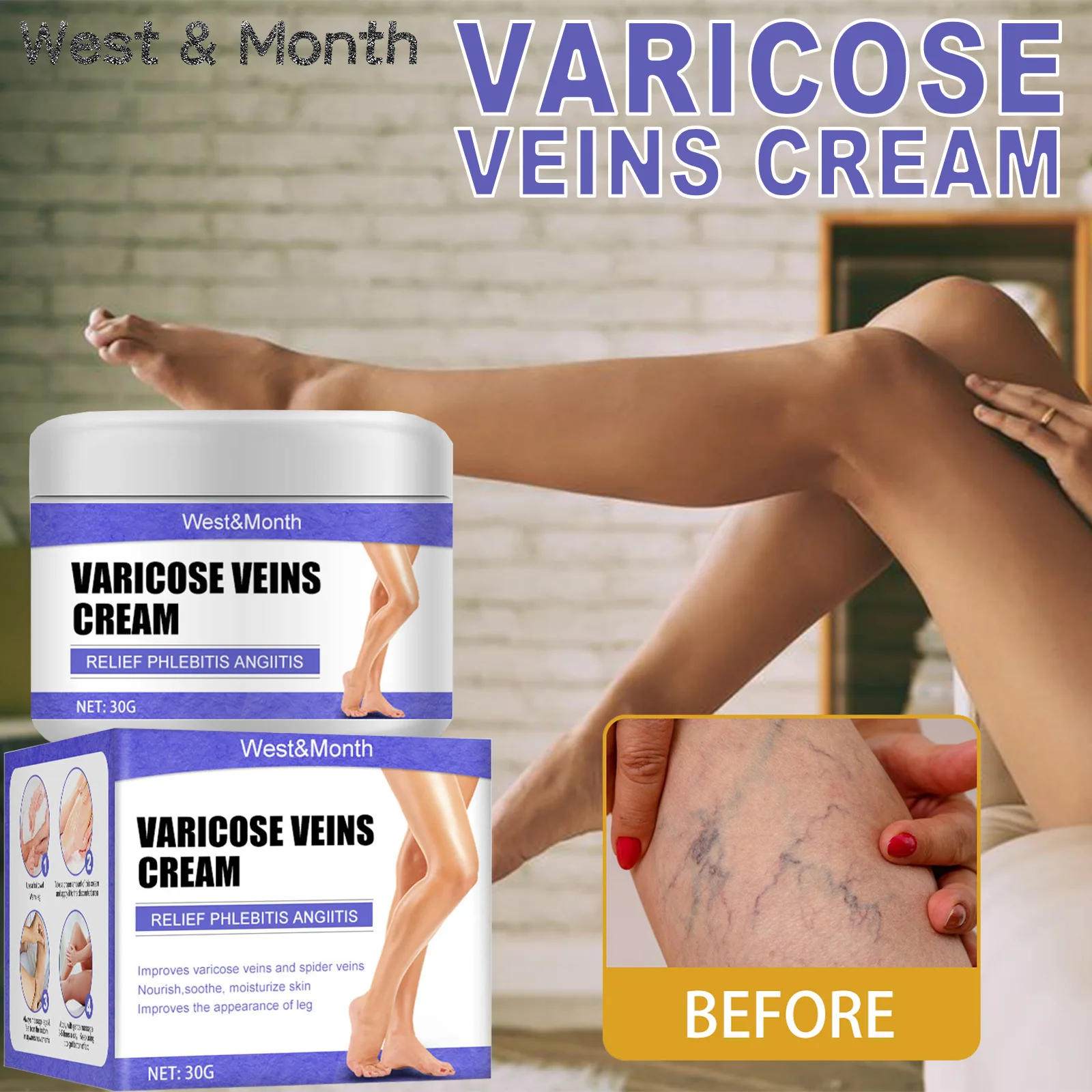 

30g Varicose Repair Cream Soothing Acid Swelling Pain Relief Plant Extracts Varicose Vein Treatment Ointment for Leg