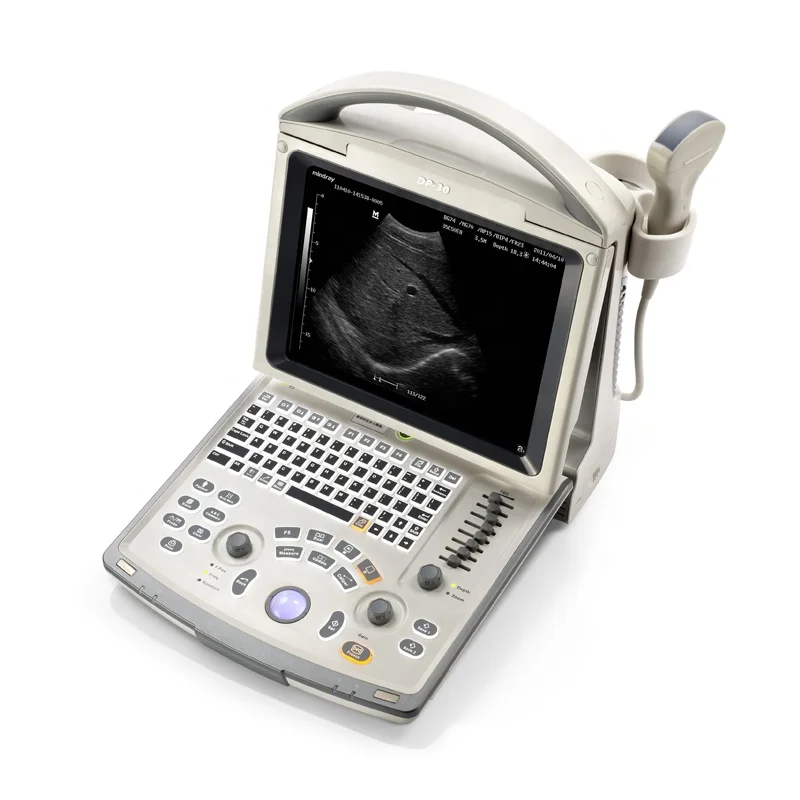 

ultrasound machine digital ultrasonic ultrasound scanner dp 30 ultrasound machine china