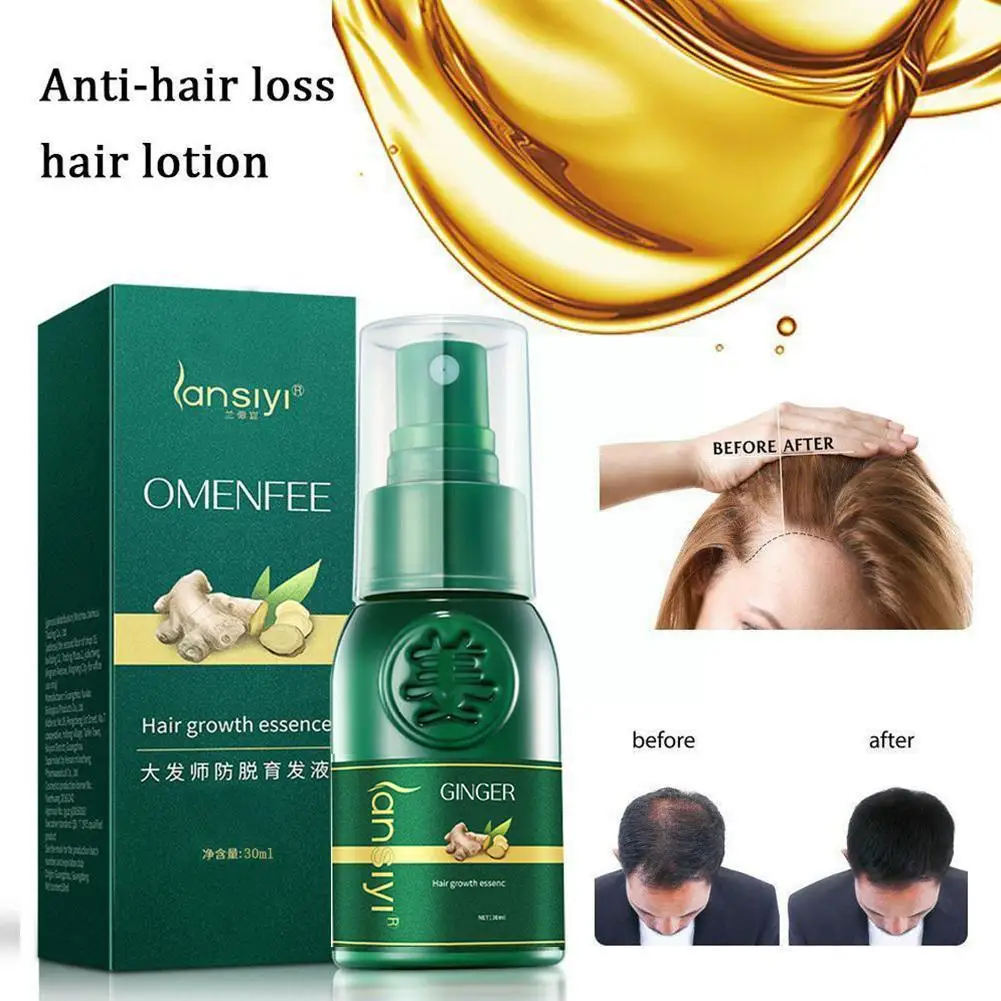 

30ML Effective Ginger Hair Growth Ointment Hair Care Nutrition Cream Anti-Hair Oil Loss Hair Healthy Damaged Essence Y5M1