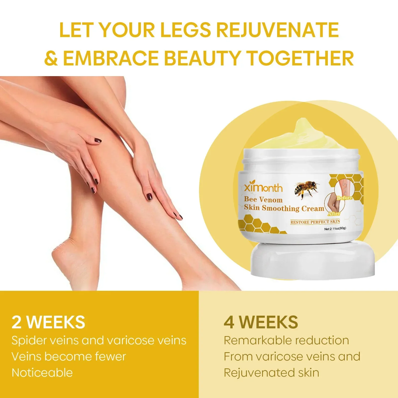 Gün제거 Bee Poison Pain Paste Venoheal Varicose Vein Ease PasteSpider Veins Easy for Legs Skin Improve Blood Circulatio 발무무 themselves