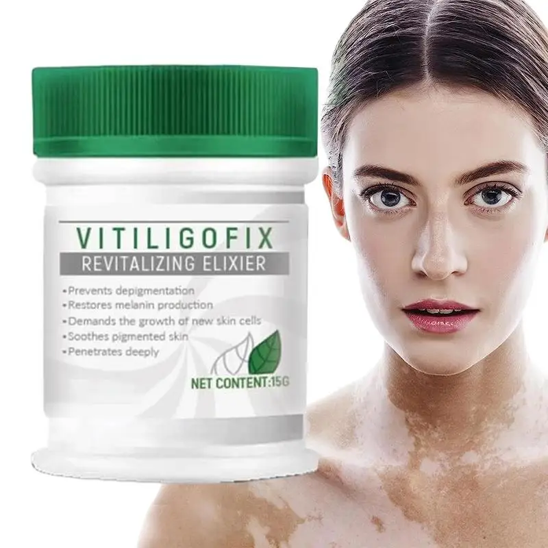 

White Spot Cream 15g White Spot Relief Cream Skin Care White Spot Removal Cream White Spot Ointment Eliminate Cream