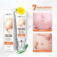 maternity scar cream pregnancy stretch marks remove cream 7 day effect essential oil skin care repair anti white stretch 45g
