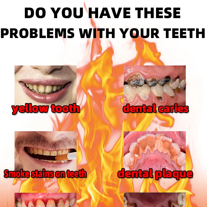 Отбеливающее средство для удаления зубной пасты стоматологическое желтых зубов