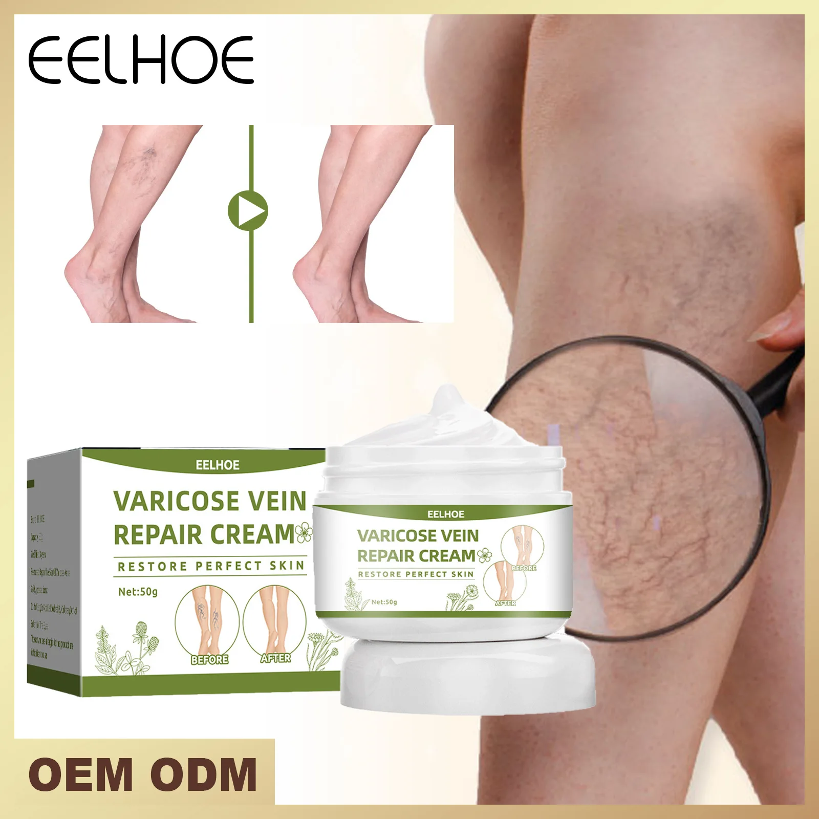 EELHOE Vein Repair Cream Tongue & Vein Relief Leg Varicose Bulge Pain Relief Cream for Earthworm Legs