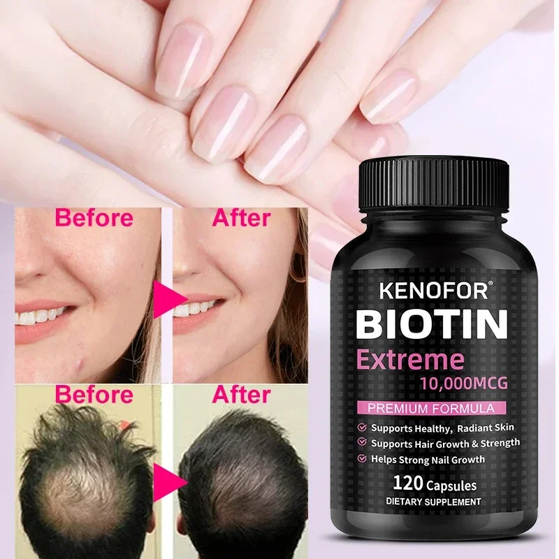 

Kenofor Natural Vitamin Biotin 10,000 Mcg, Supports Healthy Hair, Skin & Nails, Metabolism Booster - Dietary Supplement