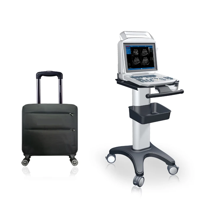 CE approved laptop portable ultrasound machine with sensor