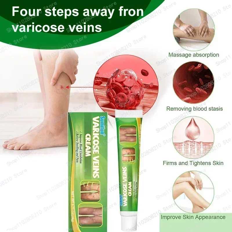 Оригинальное средство для снятия варикозного расширения вен