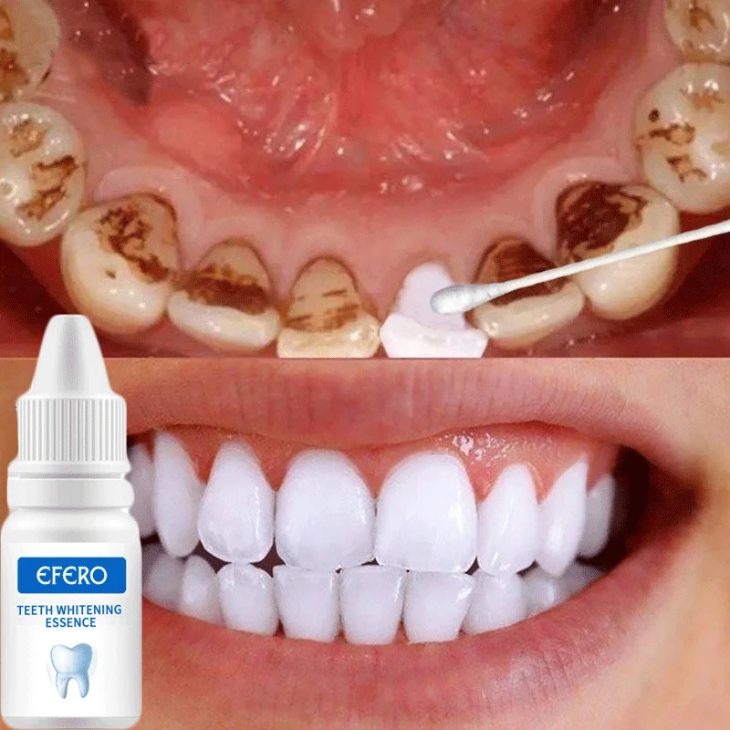 Teeth Whitening Essence Deep Cleaning Dental Oral Hygiene Remove Stains Smoke Coffee Plaque Fresh Breath Bleach Tooth Care Tools