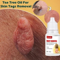 skin tag warts remove serum herbal liquid acne pimple genital warts foot corn medical antibacterial treatment patch sticker skin
