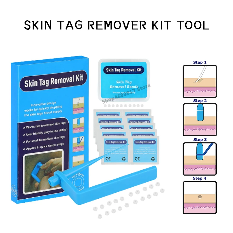 

Home Use Skin Tag Removal Kit Papillomas Treatment Skin Cleansing Tools Micro Band 4-6mm for Small To Medium Face Care Micro