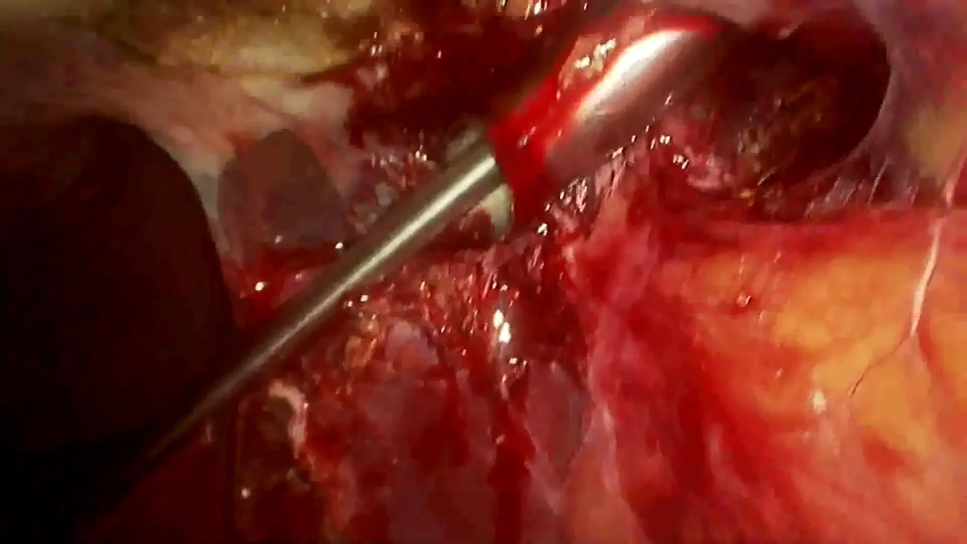 

4K Full HD Endoscopy Camera System for Ear/Nasal/Throat