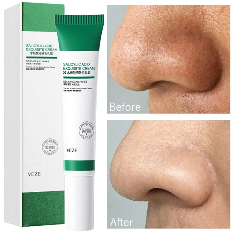 

Salicylic Acid Pores Shrink Cream Remove Blackhead Acne Treatment Moisturizing Oil Control Repairing Serum Face Skin Care 20ml