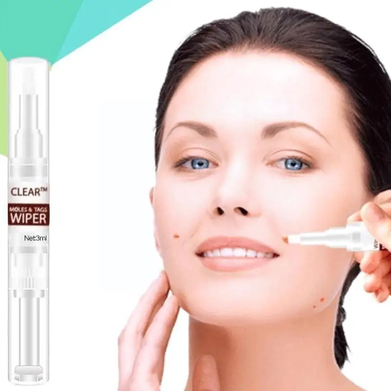 

3ml Wipeoff Tags & Moles Remover Liquid Genital Wart Skin Warts Pen Eye Beauty Pencil Corns Removal Callus Treatment Removi F1O3