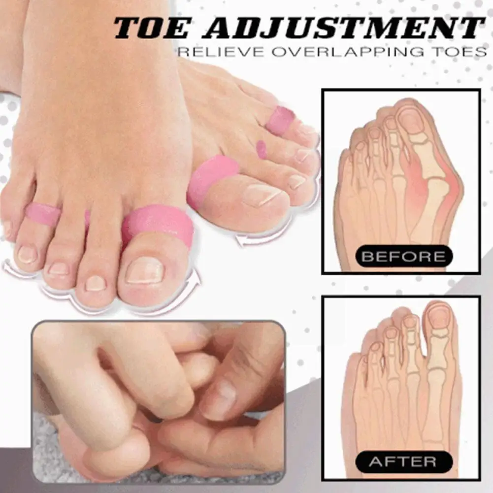 

New Style Correction Leg Toe Correction O-leg Toe Ring Toe Separator Ring Feet Separation Thin Correction Toe A2l1