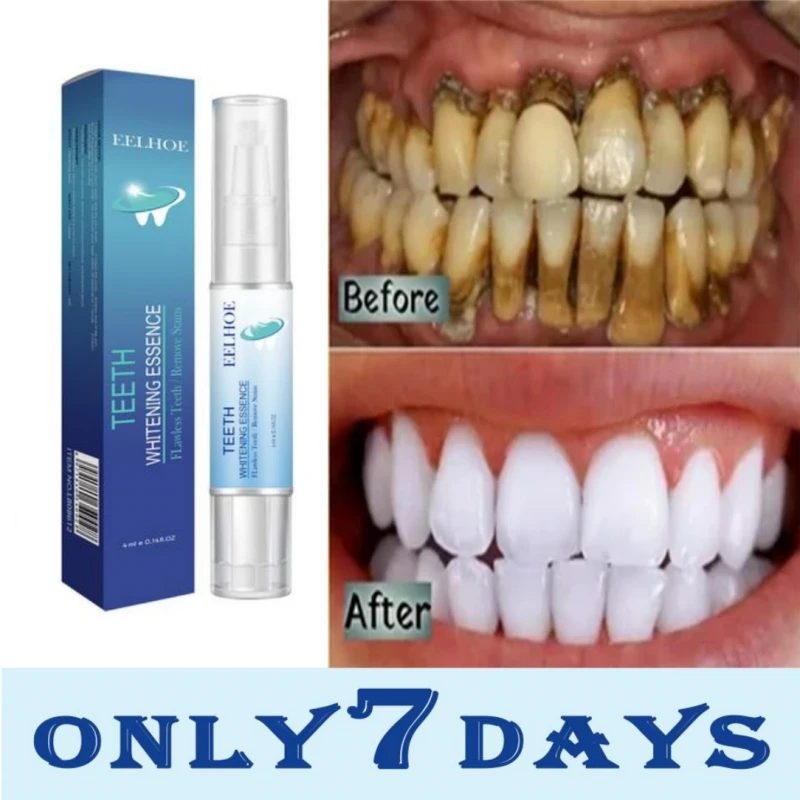 

New Teeth Whitening Pen Whitener Bleach Essence Gel Remove Plaque Stains Instant Smile Tooth Cleaning Serum Kit Beauty Health