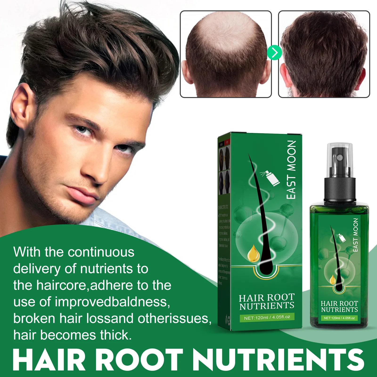 

120ml NEO Hair Growth Lotion Spray Long Hair Efficient Lotion Spray Nourishing Scalp Strengthening Hair Growth Hair Care Serum