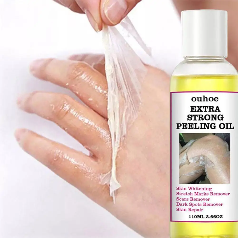 

30/110ML Extra Strong Yellow Peeling Oil Whitening Care Lighten Skin Knees Whiten Skin Elbows Hands Tone Even S0R9