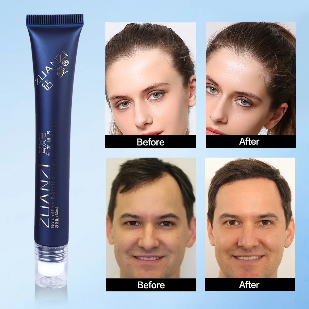 Тройной роликовый массажер для лечения выпадения волос способствует