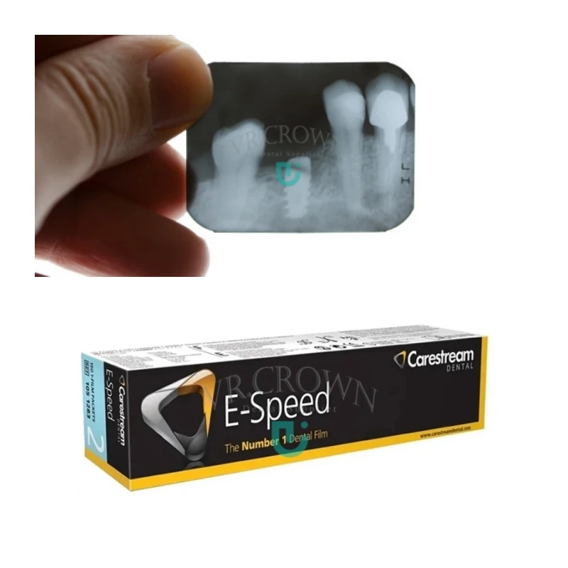 Внутриоральные рентгеновские пленки CareStream D-Speed E-Speed для использования в