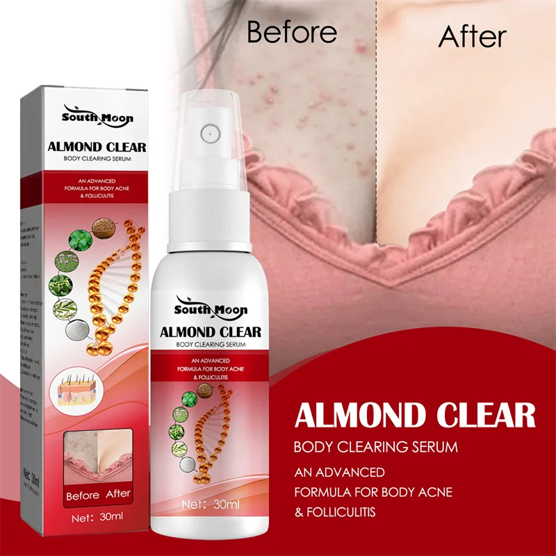 

Спрей для удаления акне, травы, облегчение боли, антибактериальный крем против зуда, покраснения и отеков спины, фолликулита