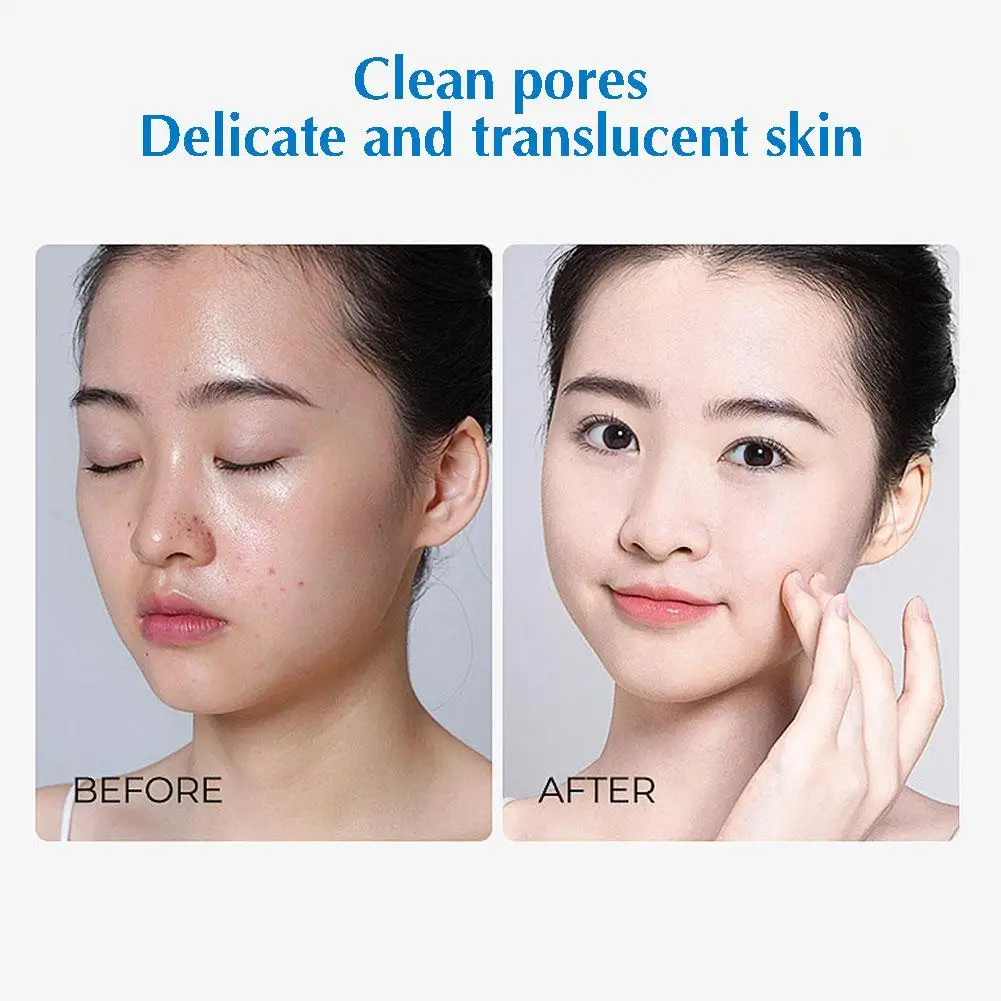 

Hydrating Facial Cleanser Face Moisturizing Whitening Moisturizing Cleanser Cleanser Foam Oily Facial Dry Skin Cleanser Y1G2