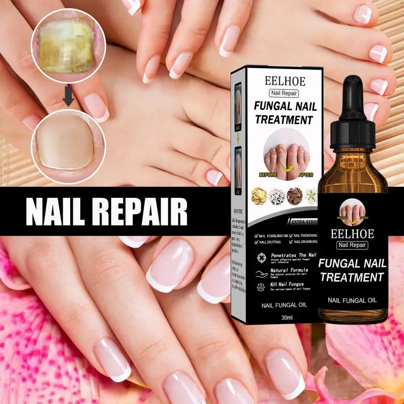 

Foot Nail Care Liquide Nail Repair Liquid for Discolored Thickened Crumbled Nails Regrowth Discolored Broken Cracked Foot Care