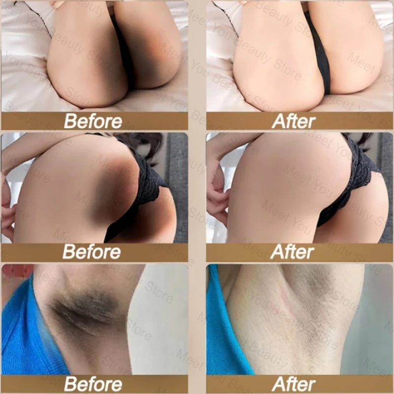 Отбеливающий крем для темной кожи подмышек бедер внутренних суставов осветление