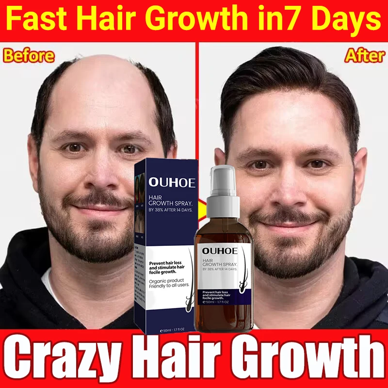 Hair Growth Spray Fast Growing Prevent Hair Loss Essential Oil Treatment Consolidating Nourish Roots Hair Health Repair Products