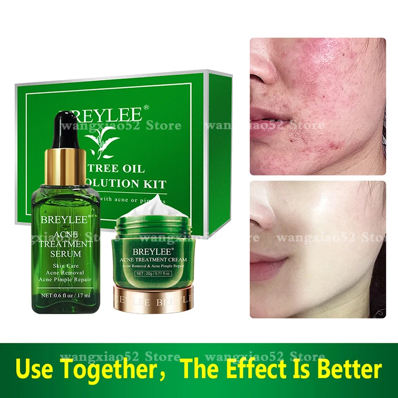 

Facial care, witch hazel improves acne, fades acne marks, improves blackheads, hydrates, moisturizes, tea tree acne set